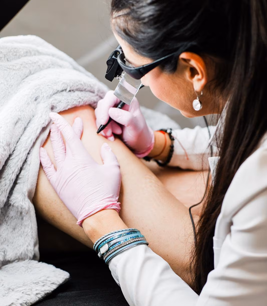 Electrolysis hair removal treatment at Calypso Beauty